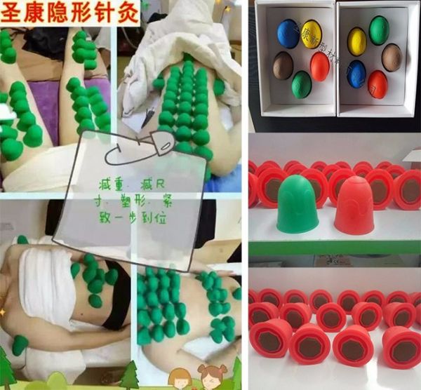 针灸.jpg